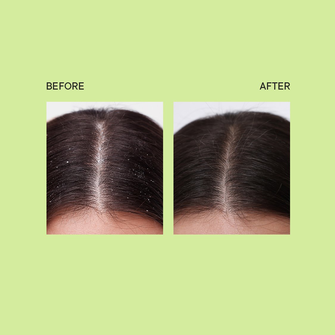 QUENCH Dandruff Control Scalp Scrub With Tea Tree Extracts - 200ml