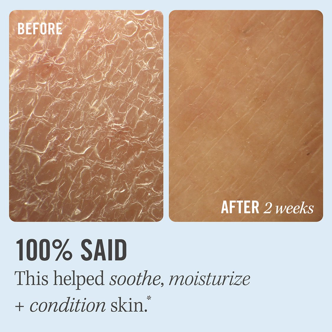FIRST AID BEAUTY Ultra Repair Cream - 170.1g