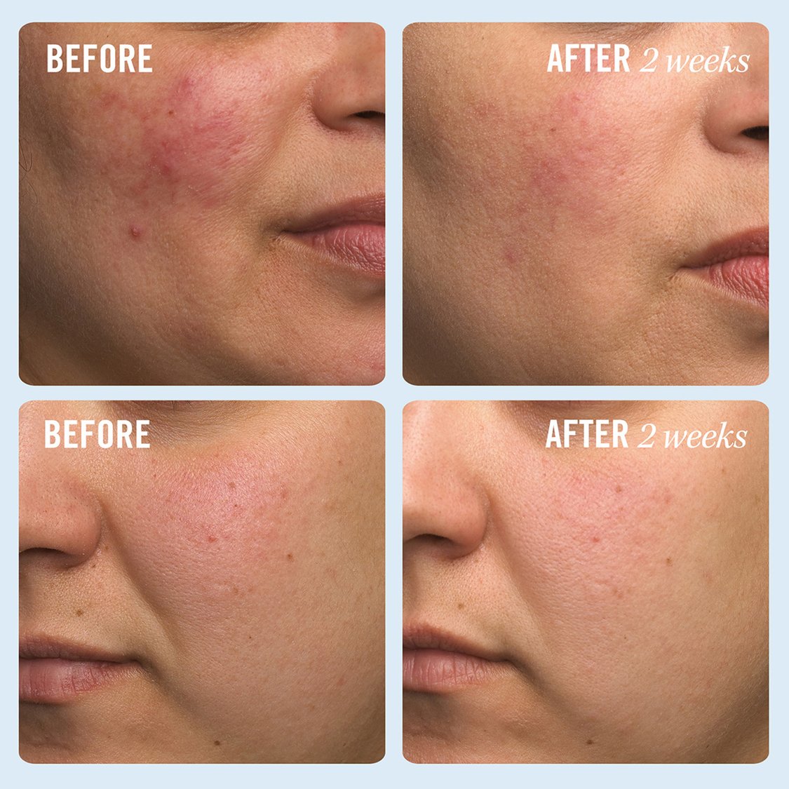FIRST AID BEAUTY Ultra Repair Cream - 170.1g
